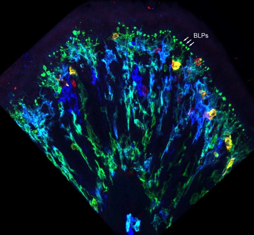 Coupe_colon_Macrophages et BLP-96b2ea7c